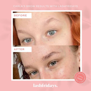 brow serum results