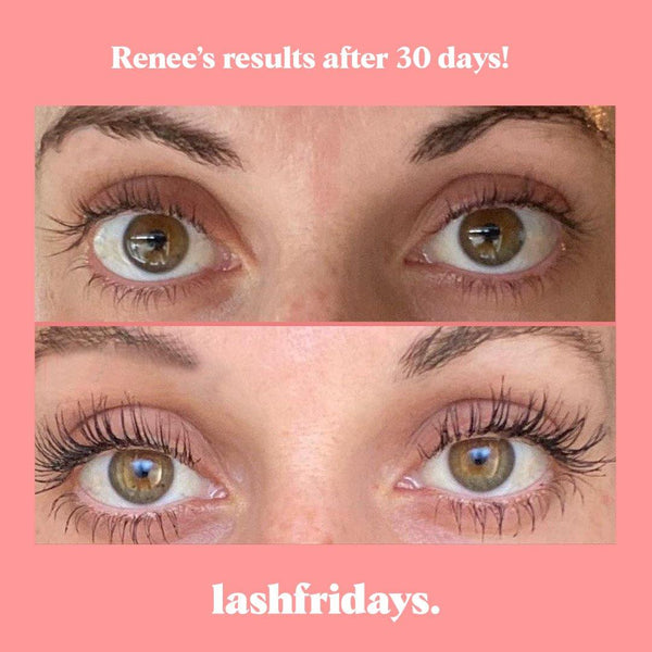 Eyelash Serum - lashfridays
